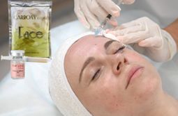 Пилинг с экзосомами и карбокситерапия