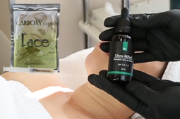 Миндальный пилинг и карбокситерапия